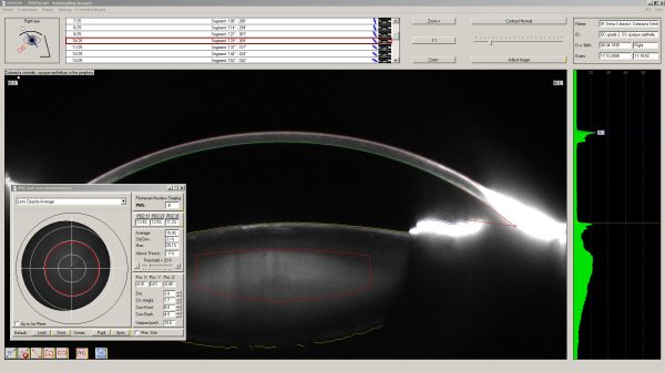 Oculus - Pentacam Family - Image 2