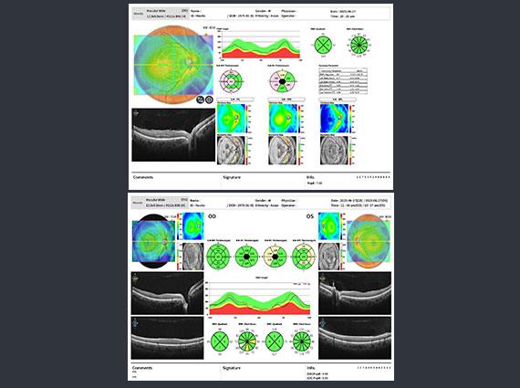 Huvitz - OCTavius - Image 3
