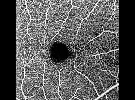 Huvitz - OCTavius - Image 5