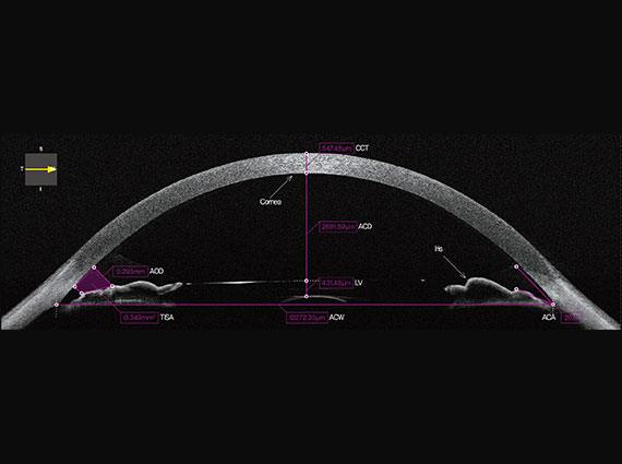 Huvitz - OCTavius - Image 4
