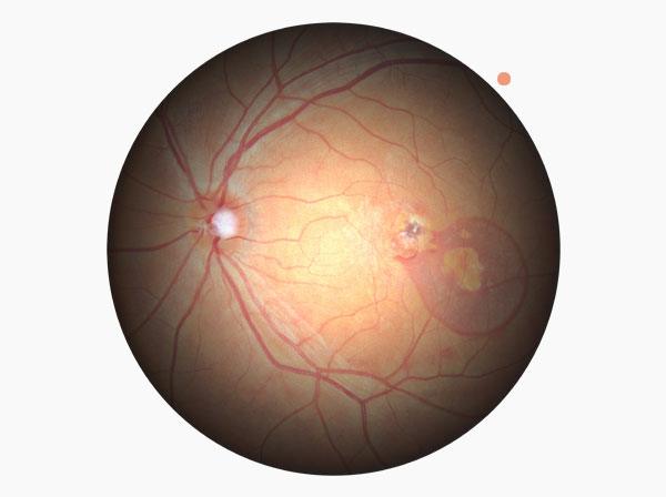 Huvitz - OCTavius - Image 6