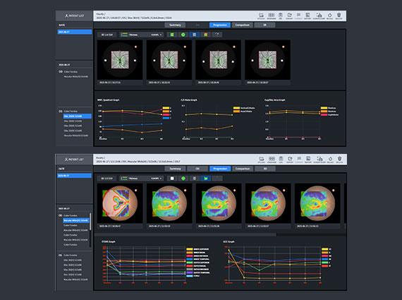 Huvitz - OCTavius - Image 2